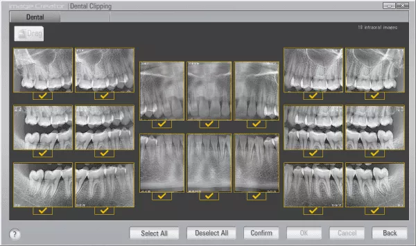 ImageWorks | Panoura X-era  3D Dental CBCT Scanner - Image 4