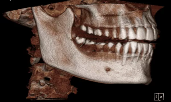 ImageWorks | Panoura X-era  3D Dental CBCT Scanner - Image 3