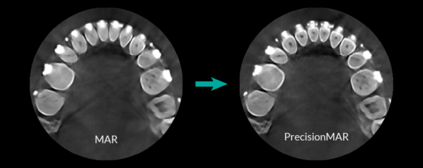 HDX Will Performance Radiology | Panoramic X-ray System | eco-x2020-08-24 - Image 6