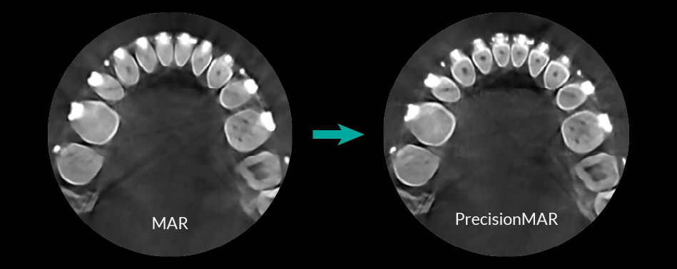 HDX Will Performance Radiology | Panoramic X-ray System | eco-x2020-08-24 - Image 6