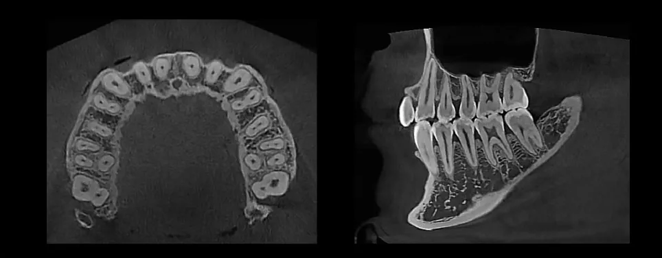 HDX Will Performance Radiology | Panoramic X-ray System | eco-x2020-08-24 - Image 7