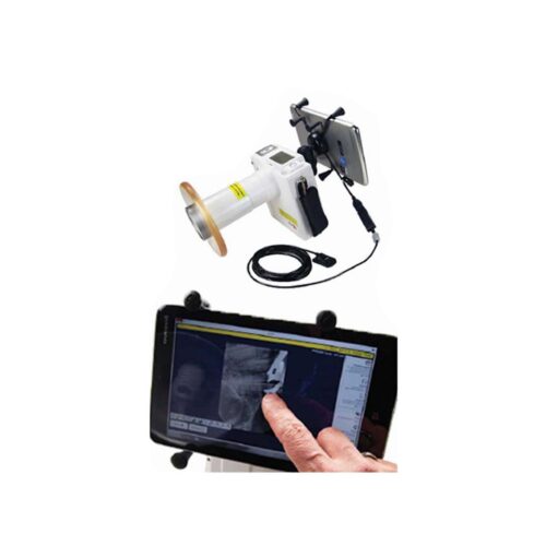 MAX‐Ray DX‐P400 8" Tablet mounting Kit (w/o Tablet) - Image 2